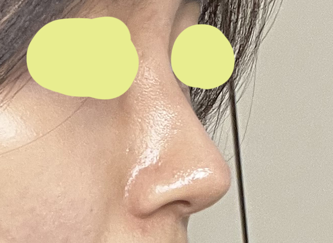 코 예쁘게 자리잡아서 좋아요 ㅎㅎ