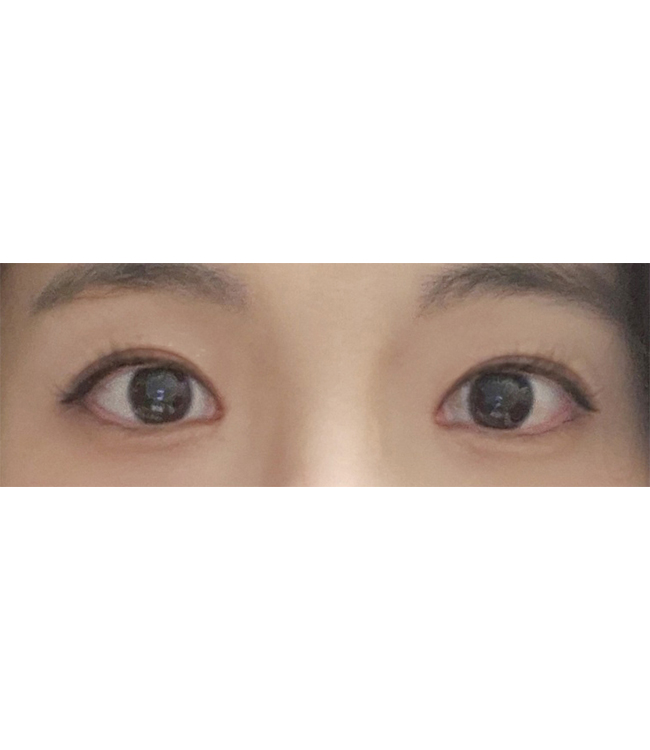 눈매가 또렷해지고 예뻐졌어요~