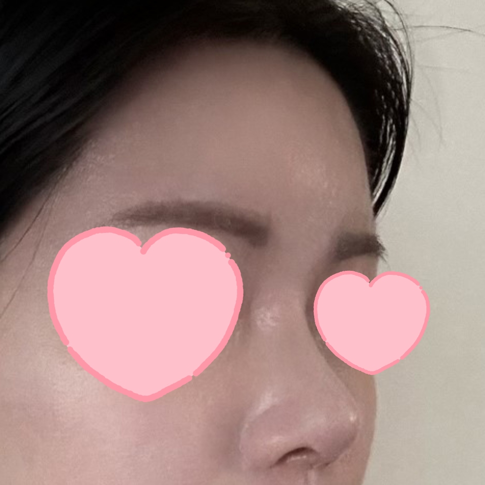 수술 후 자신감이 생겼어요