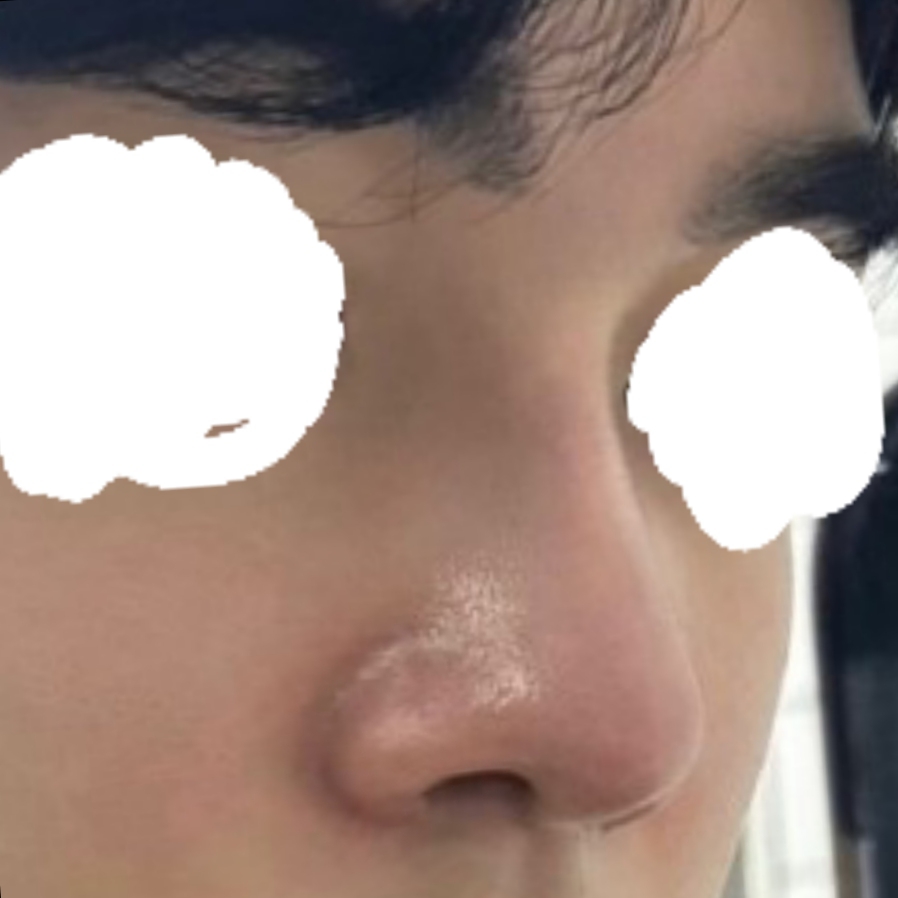 자연스러운 코 ! 만족스럽습니다