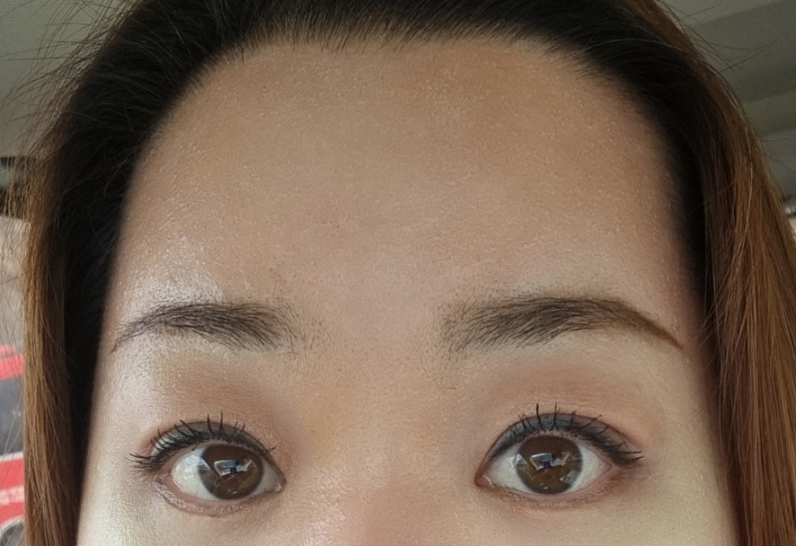 상안검과 이마거상 1개월입니다