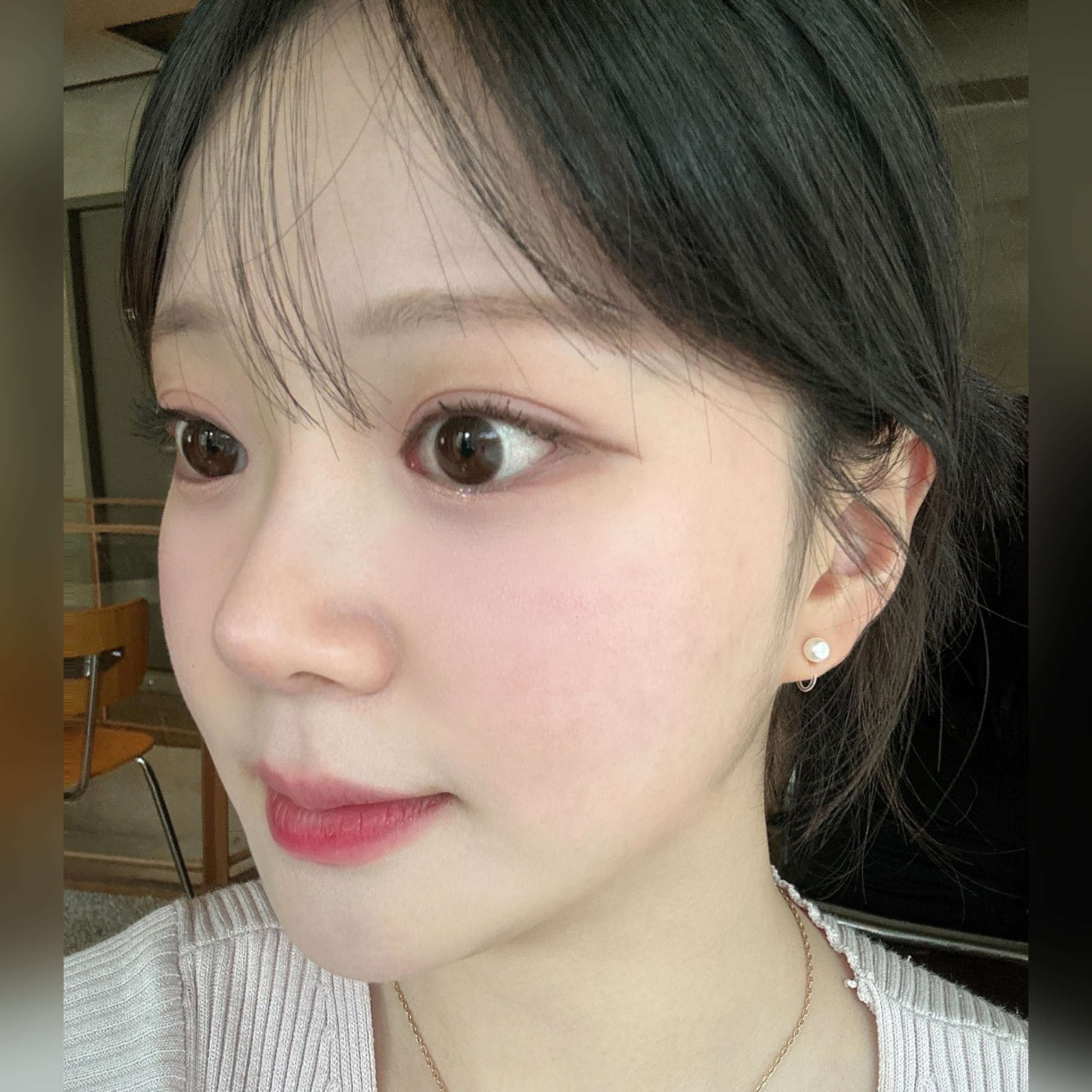 너무 만족스러운 코재수술! (11개월차)