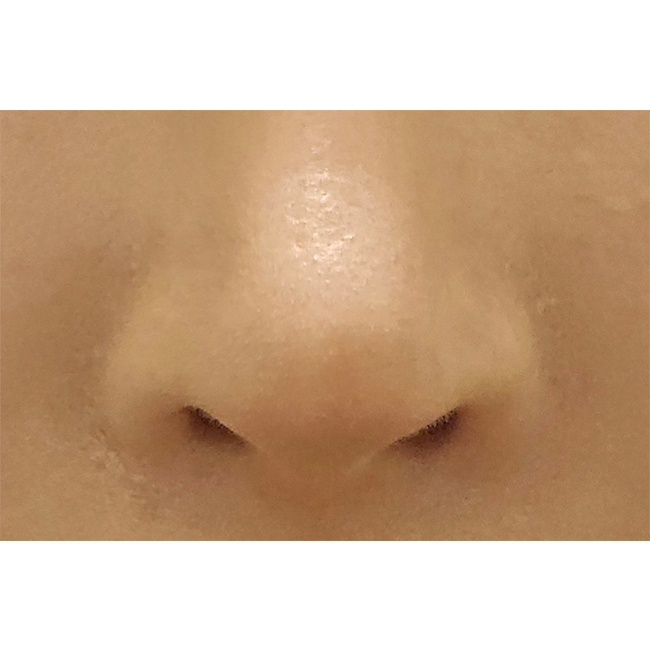 비공내리기 4개월차~~