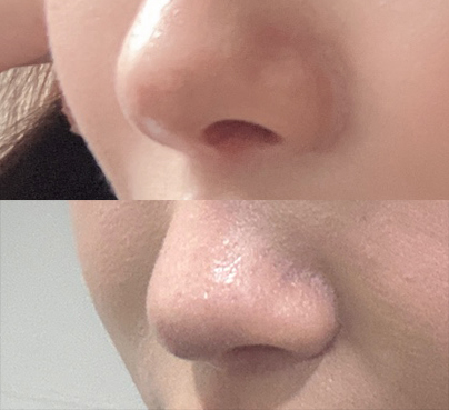 콧구멍짝짝이 개선된 후깅~