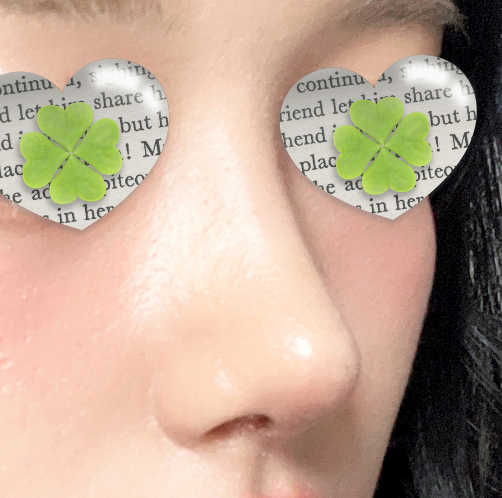 유영문원장님께 복코수술 받았어요!