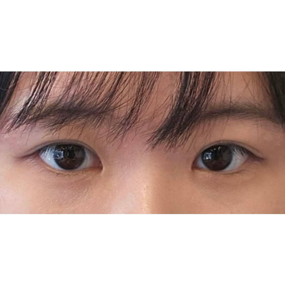자연스러운 예쁜 눈 만들어주셔서 감사합니다 !