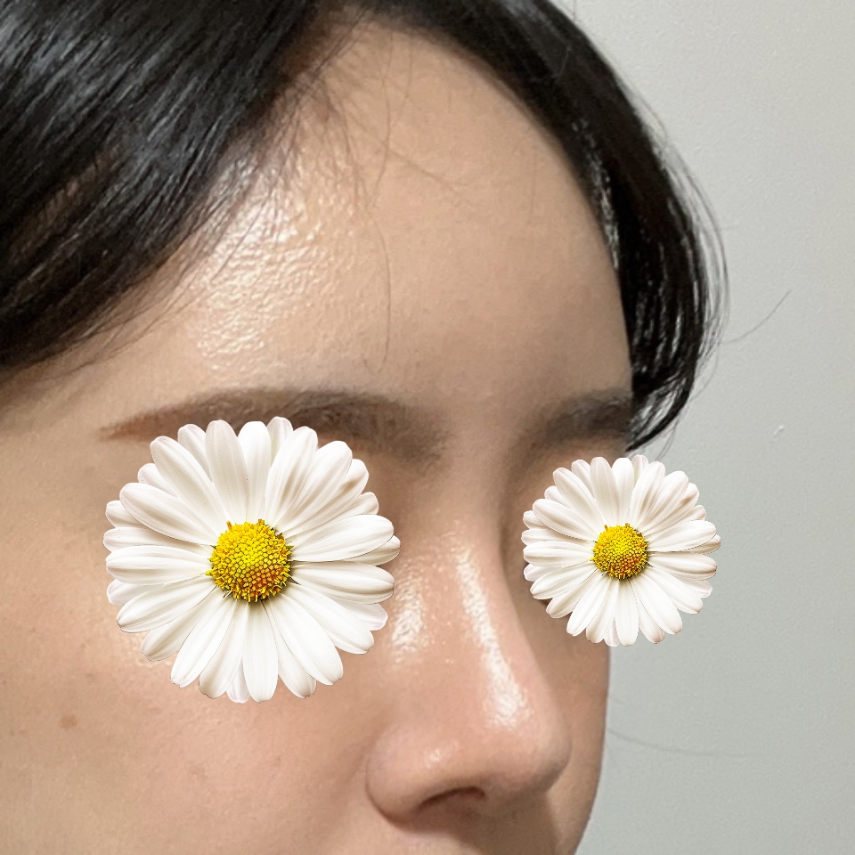 원장님 덕분에 삶의 질 상승 했습니다 ㅎㅎ