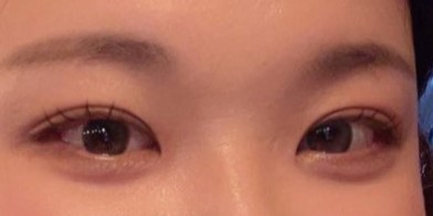 이제 전 눈은 생각도 안나요 !