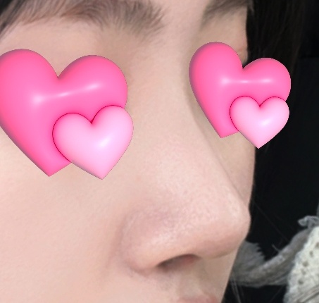 제 얼굴에 어울리는 코 만들어주셨어요:)