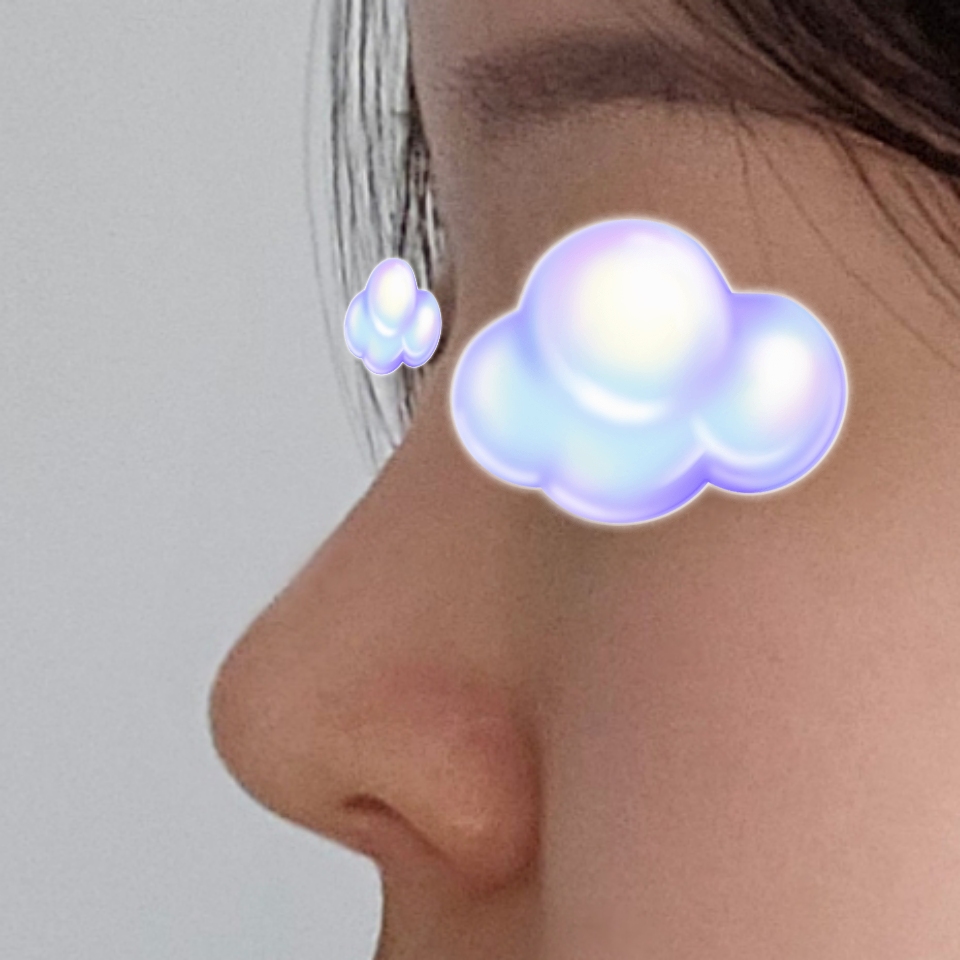 바이브 코성형 적극추천입니다!!