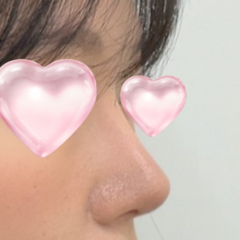 코가 예쁘게 자리 잘 잡았어요 ㅎㅎ