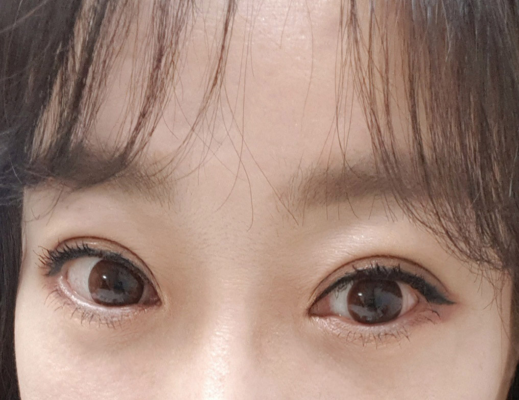 눈, 이마거상후기에요~더 어려보이는 느낌^^