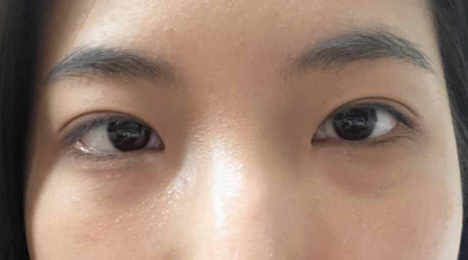 눈이 커지고 또렷해졌어용