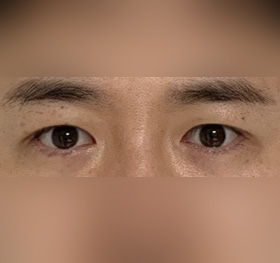 다들 친절하시고 수술 잘돼서 만족합니다.