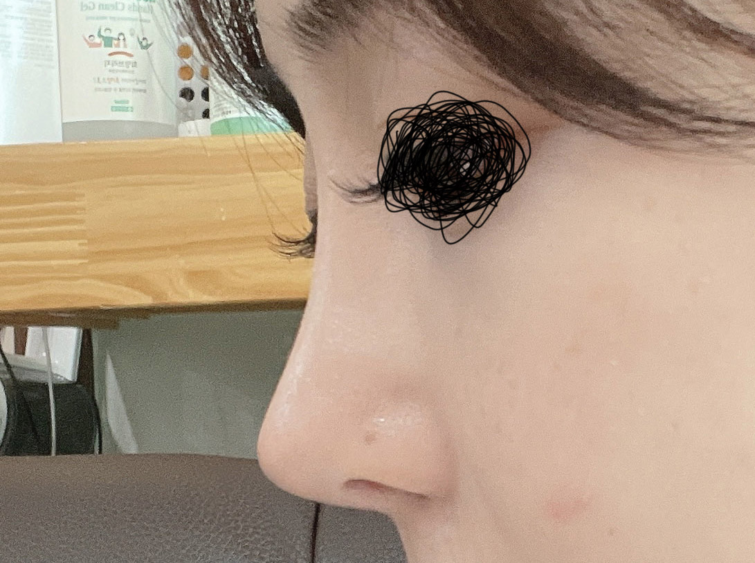 수술후_1_-1.jpg