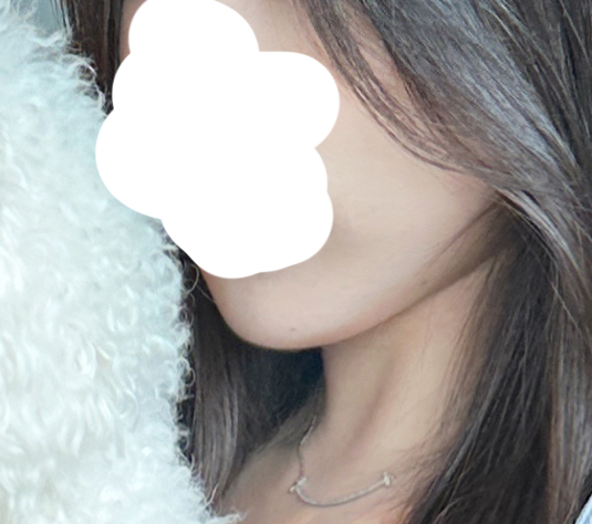 얼지흡 하니까 없었던 턱라인이 보여요~!