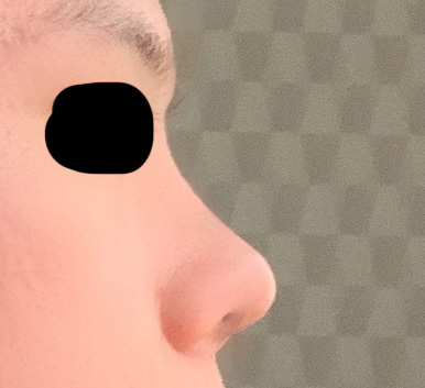 군전역후 바이브에서 코했습니다!