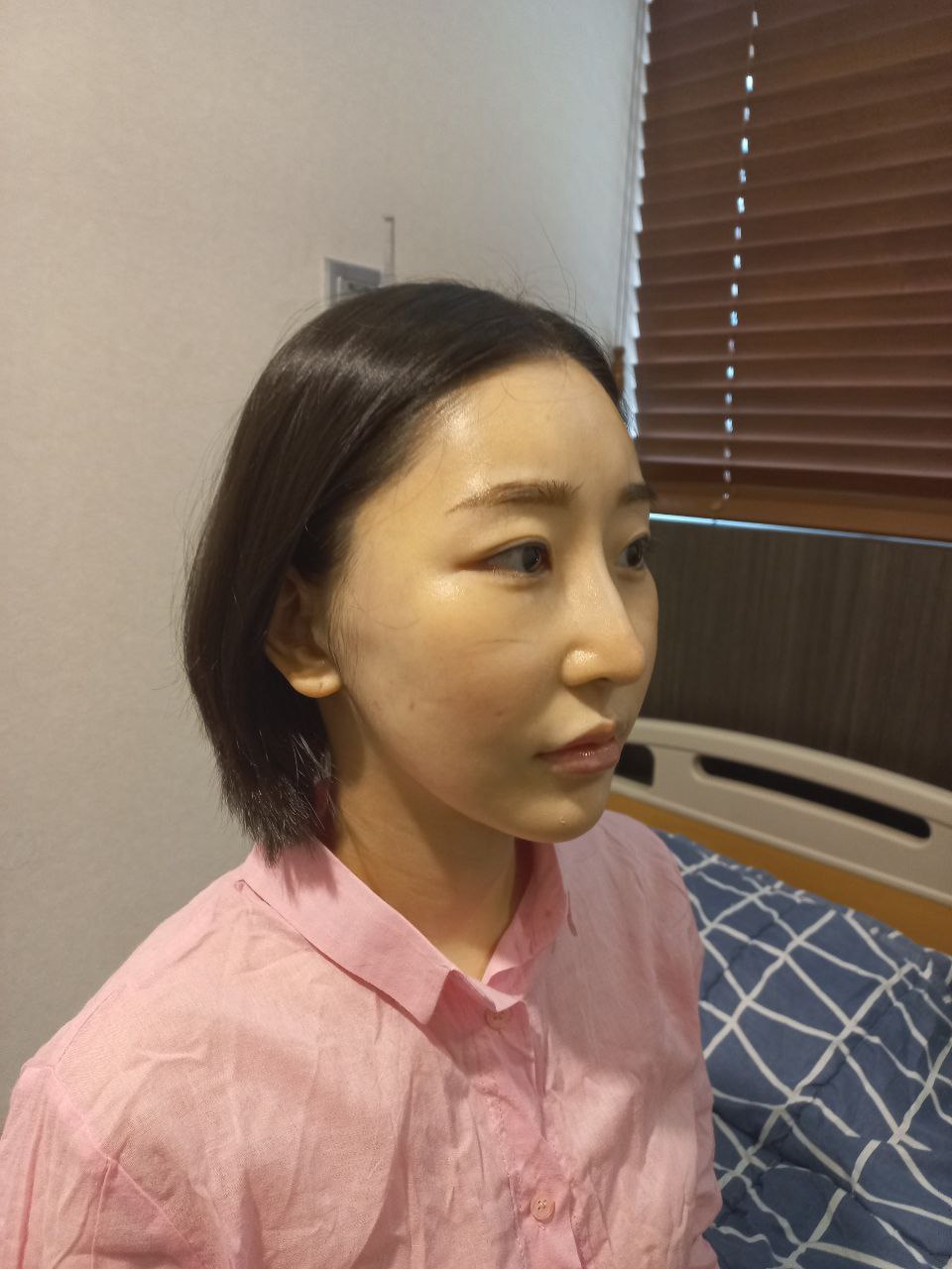 수술전_1_.jpg