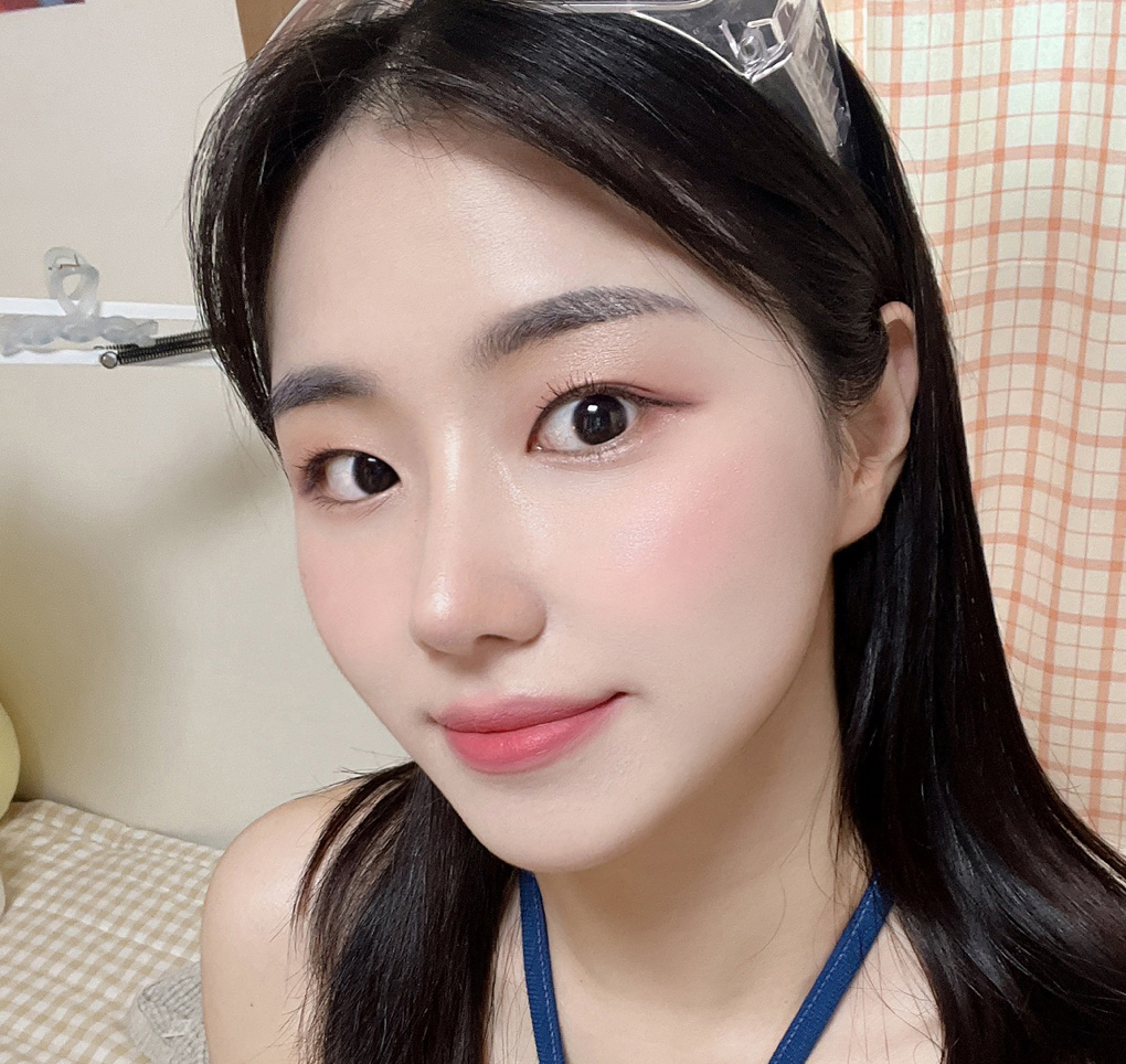 코수술 4개월차!완전 만족해용