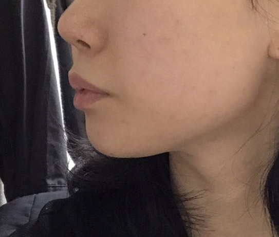 지흡결과 맘에들어용~