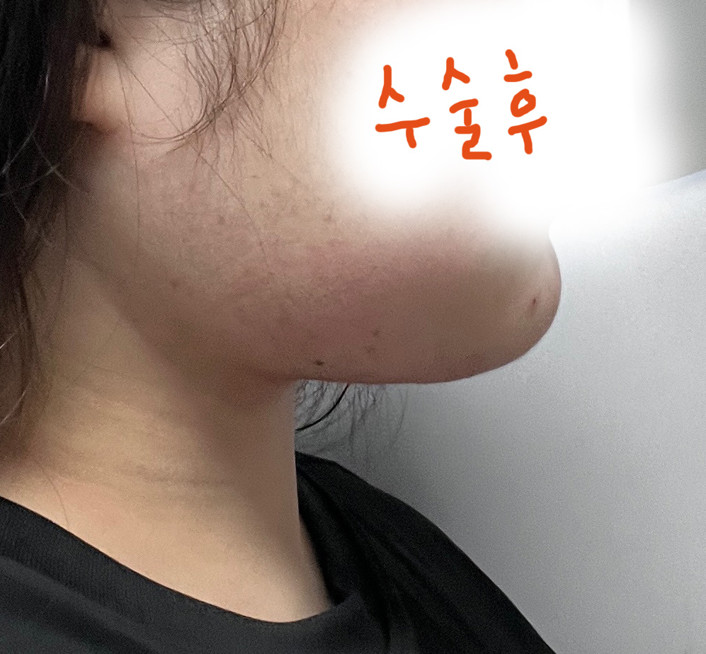 수술후_1_.jpg