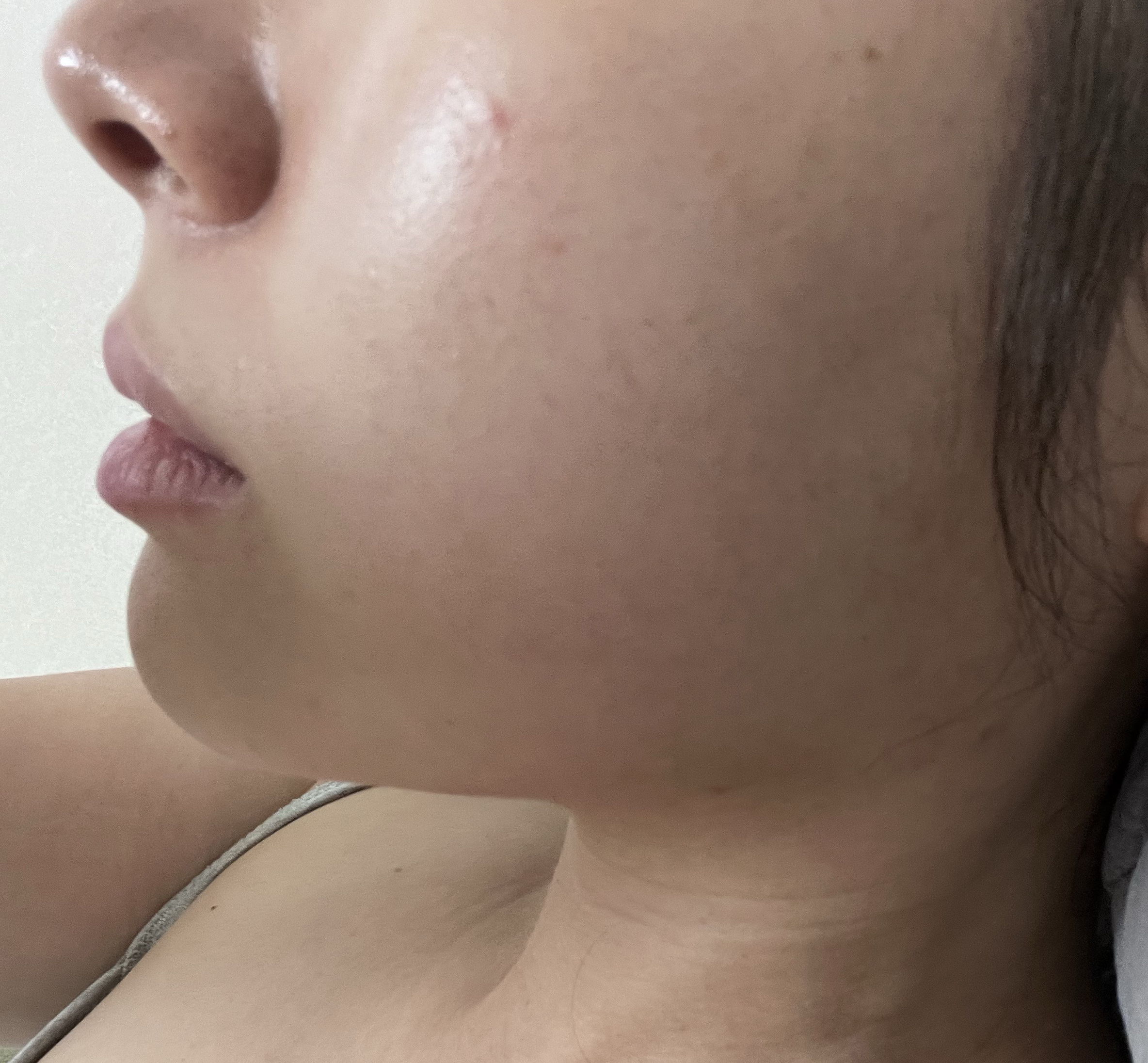 투턱살 쏙쏙 빠져서 넘굿!!