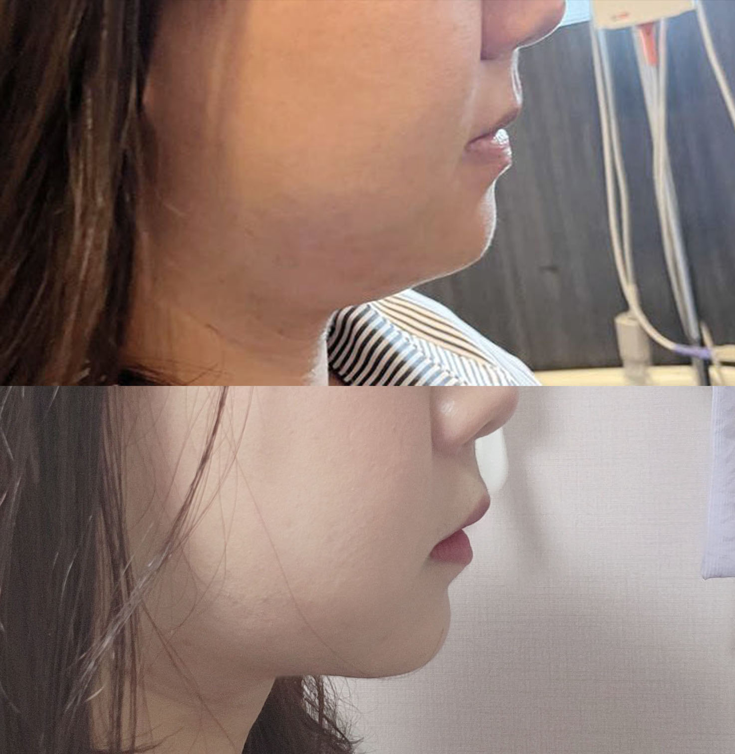 이중턱이 줄어들어서 넘 만족 ㅠㅠ강추!!