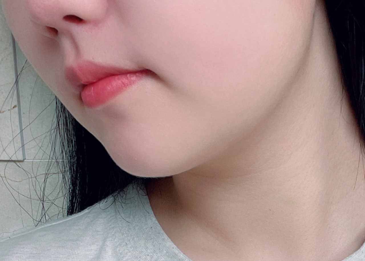없던 턱라인이 생겼어요..ㅎㅎ