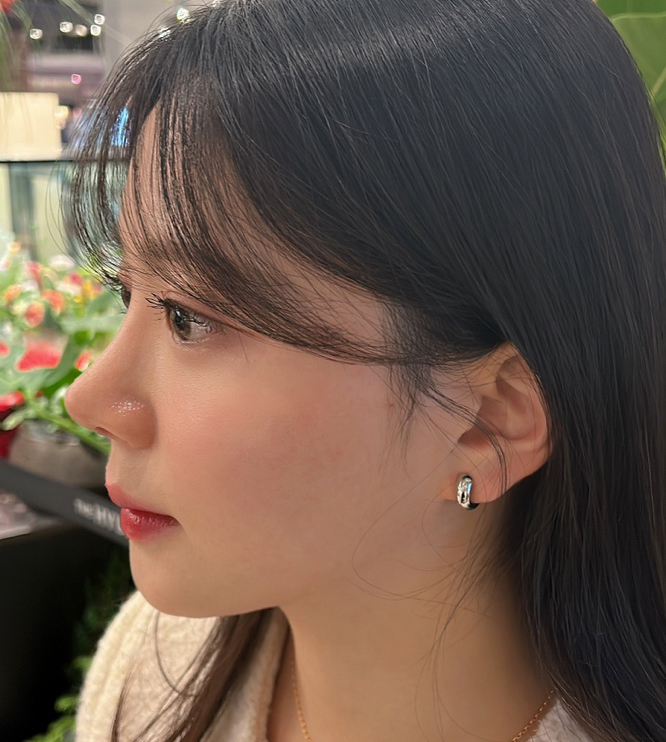 코재수술1달차! 첫코도 바이브에서 할걸그랬어요