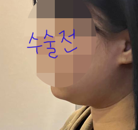 수술전_1_.jpg