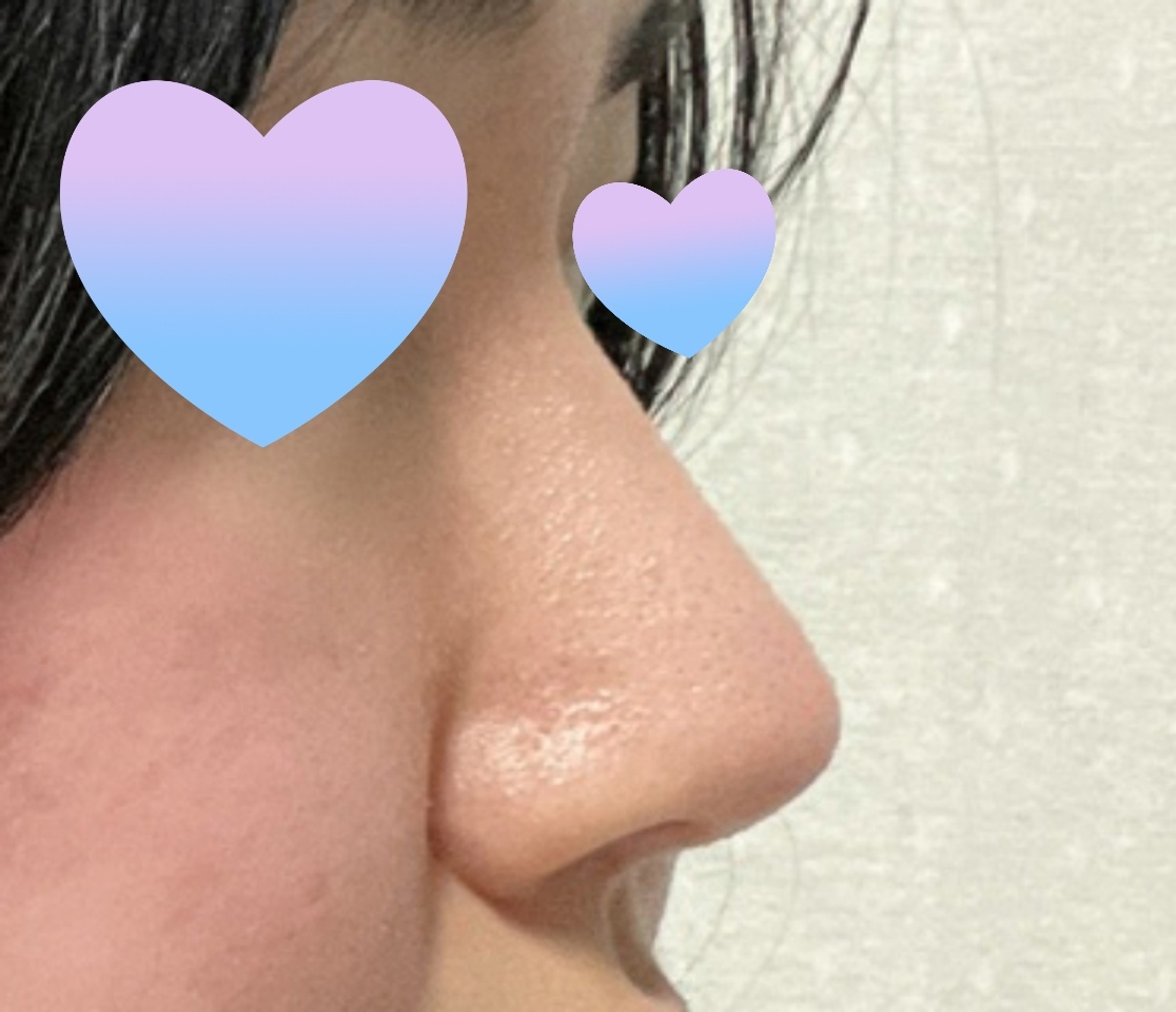 쌍수랑 코 같이한 후기