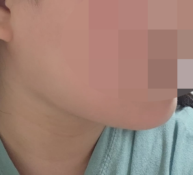 점점 라인이 달라지네요 ㅠㅠ굿굿!