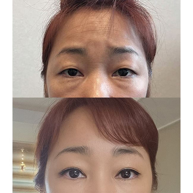 주변에서 정말 잘됐다고 하네요~~ㅎ