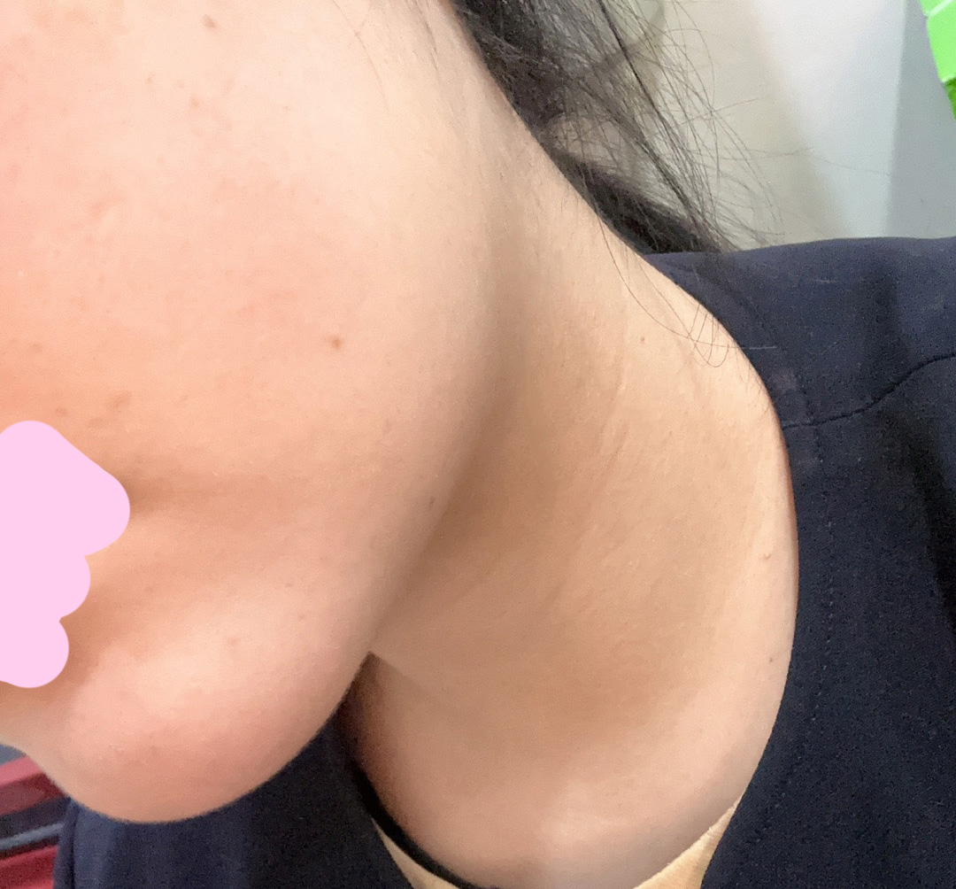 턱이 날렵해져서 요즘 자신감상승ㅎㅎ