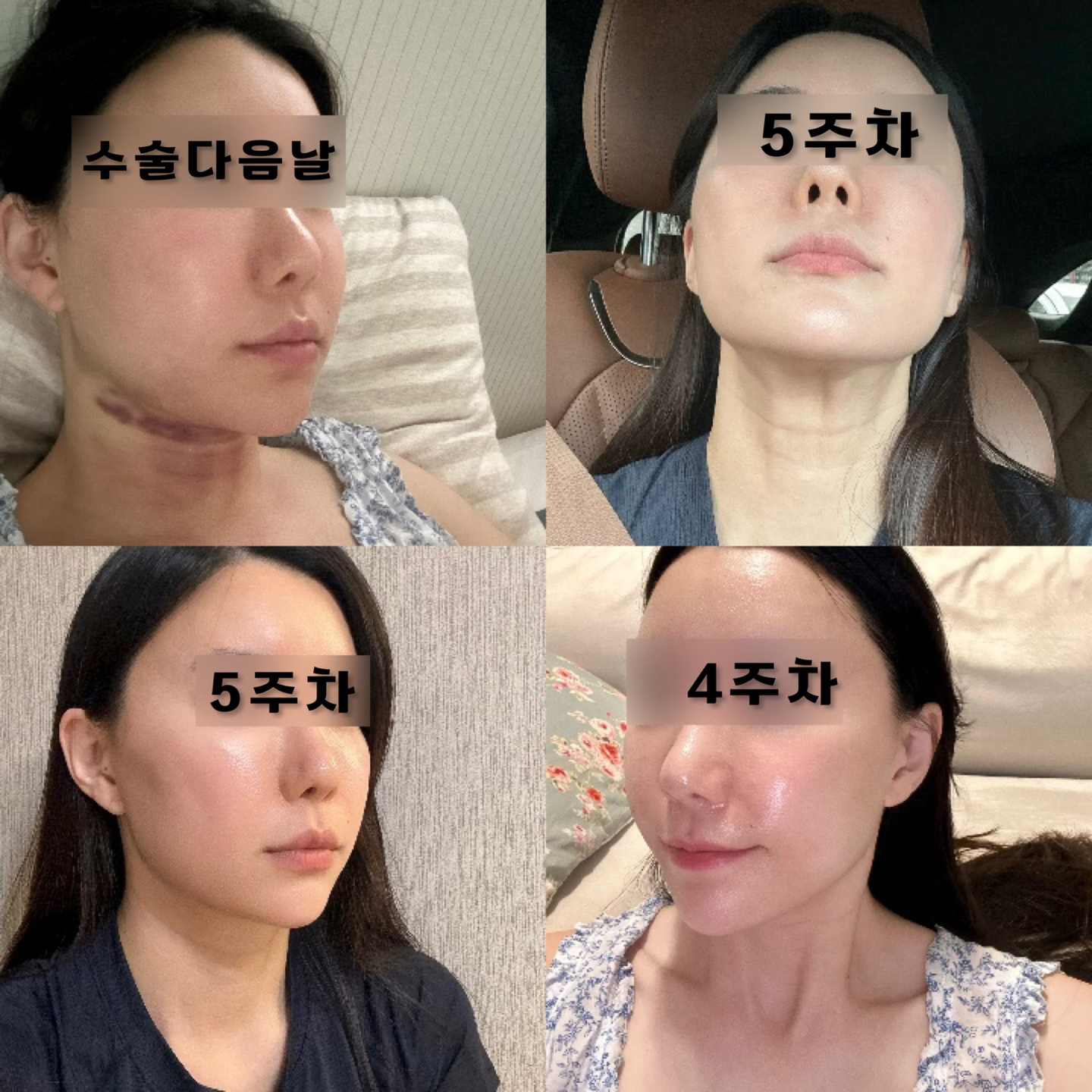 유원장님께 10000점 드리고 싶습니다 ㅎㅎ지흡효과굿