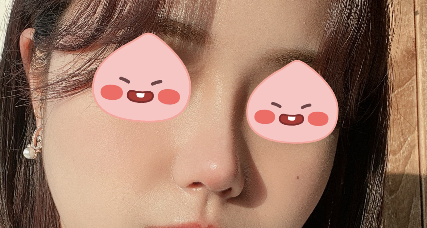 불편한점 없이 예쁘게 해주셨어요(코4개월차)