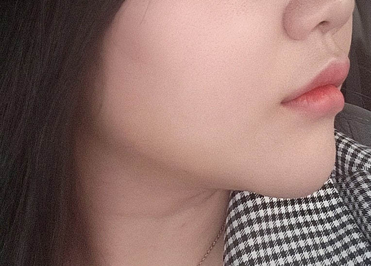 이중턱하나는 정말 끝내주게  소멸됨