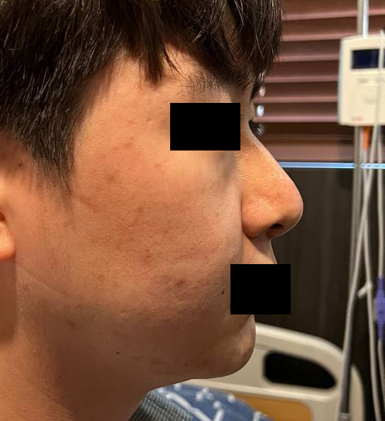 수술전_1_.jpg