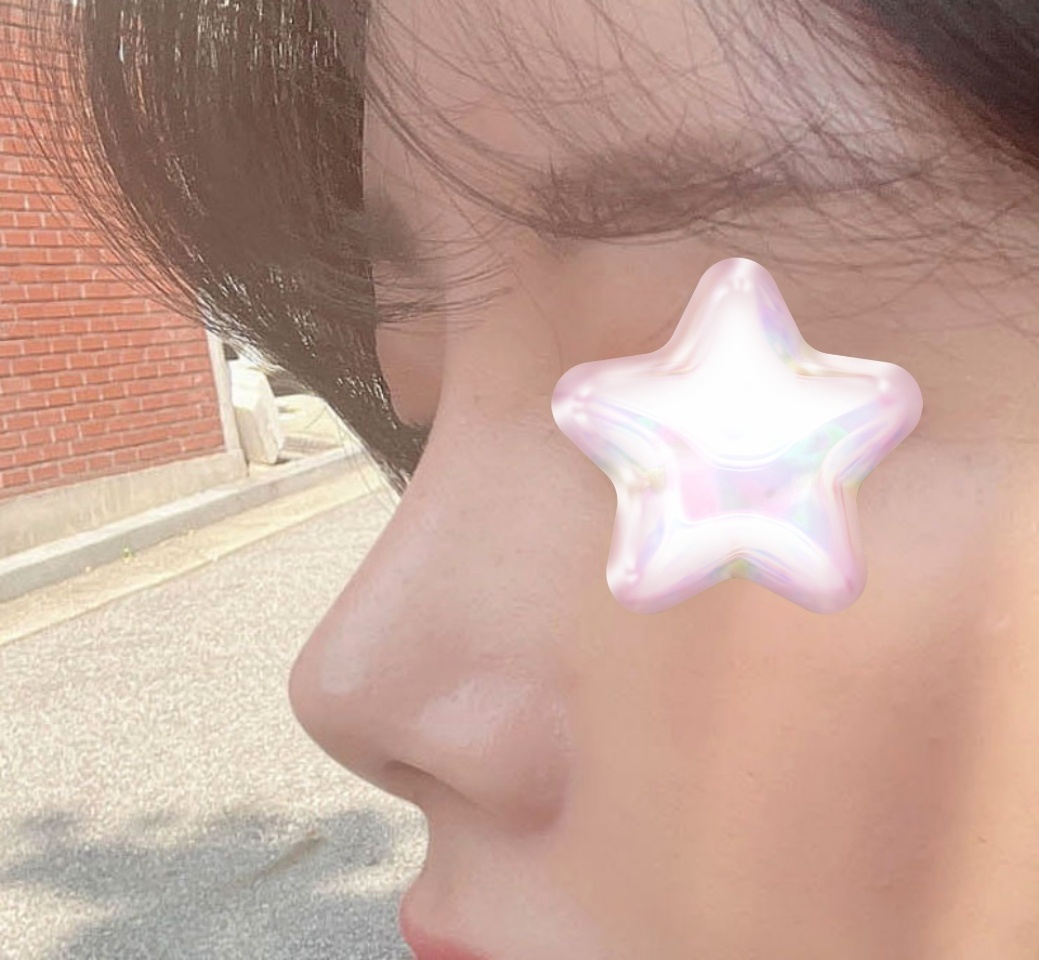 첫코수술 성공적><!!