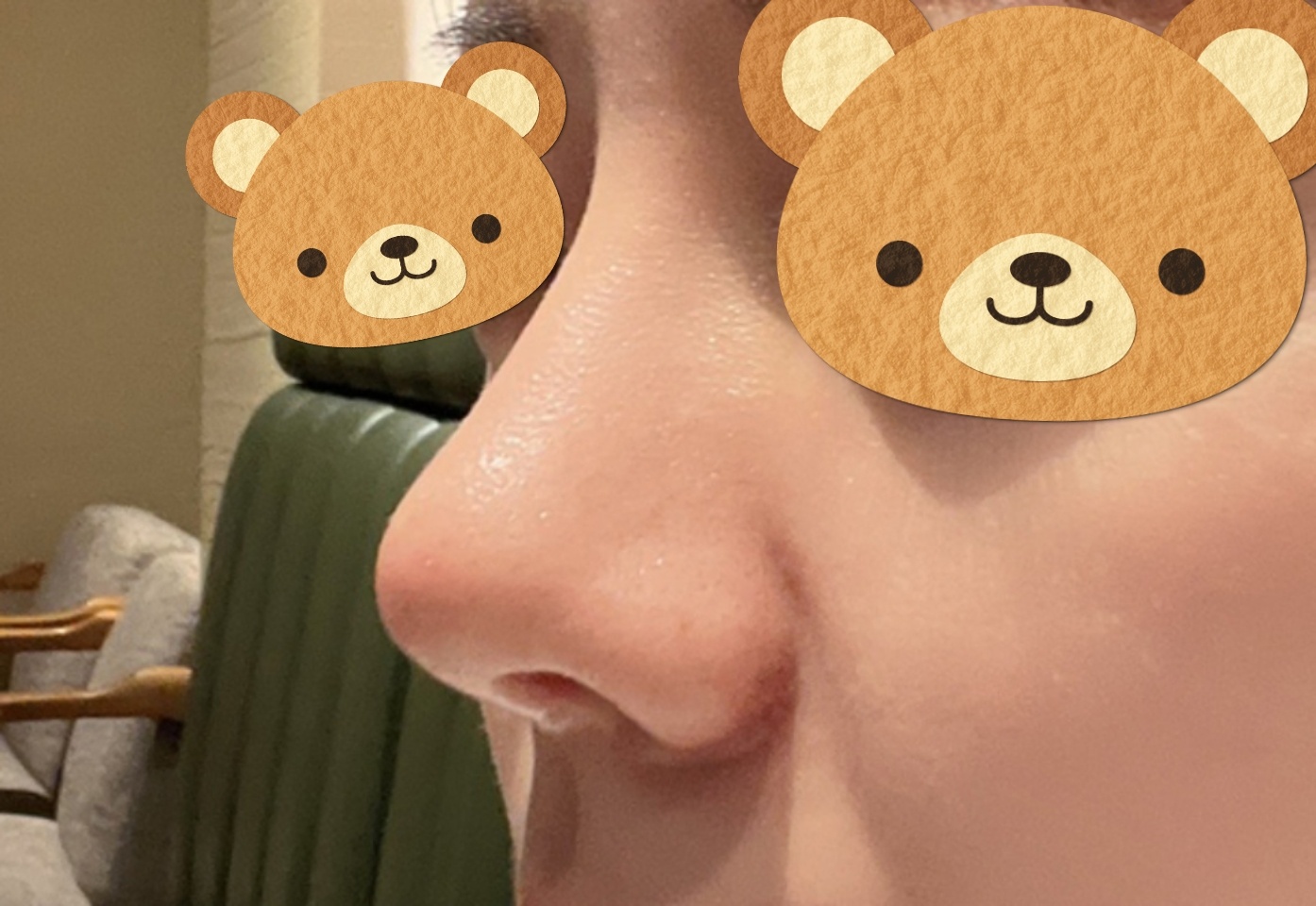 들창코, 복코 였던 코! 얄쌍해져서 만족