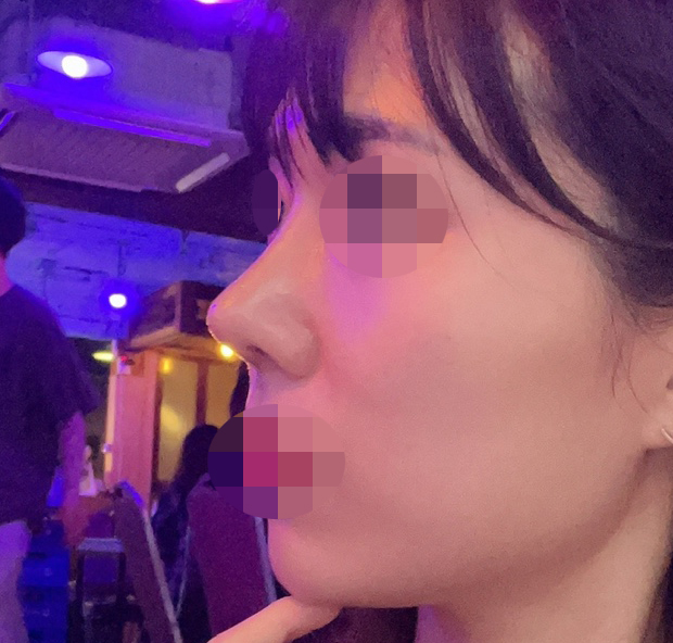 친구가 여기서 코잘돼서 저도 했어요 ㅎㅎ