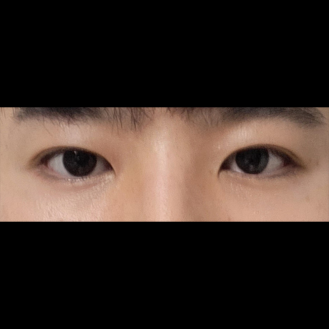 졸린 눈에서 또렷한 눈으로 됐습니다:)