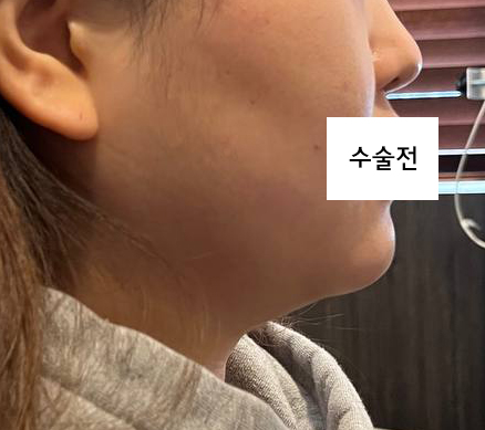 수술전_1_.jpg