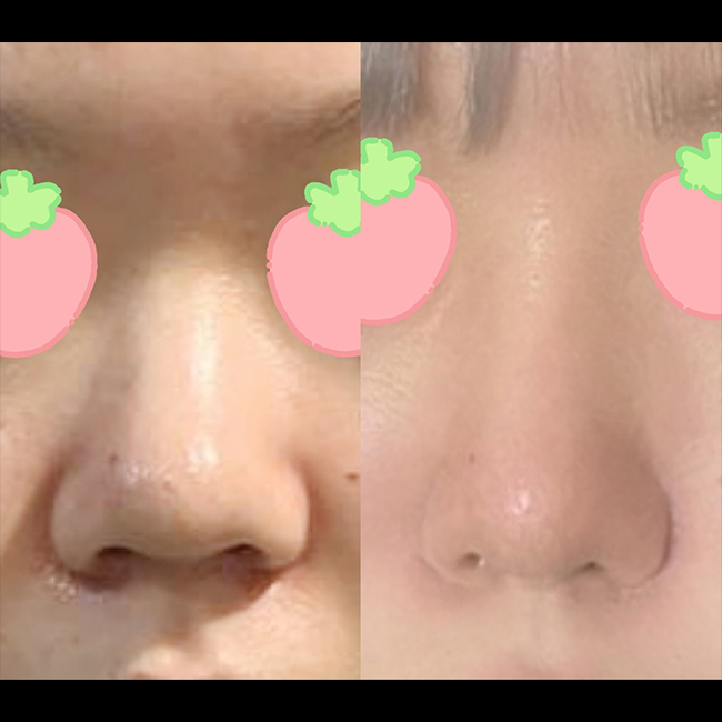 1._수술전후정면.jpg
