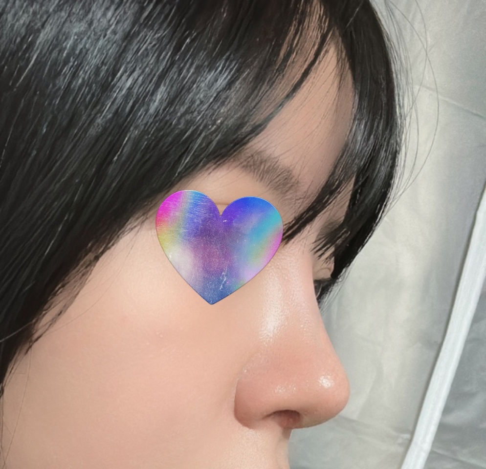 코성형 결과도 만족하구 다들 친절친절 ㅠㅠ