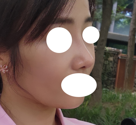 수술후_2_-1.jpg