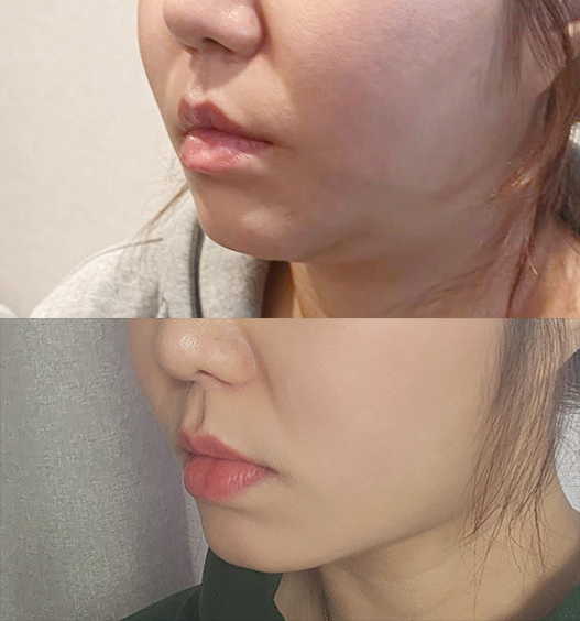 얼지흡하구 턱이 갸름갸름!!