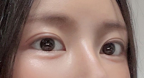 유영문원장님의 손기술 대박이에요~