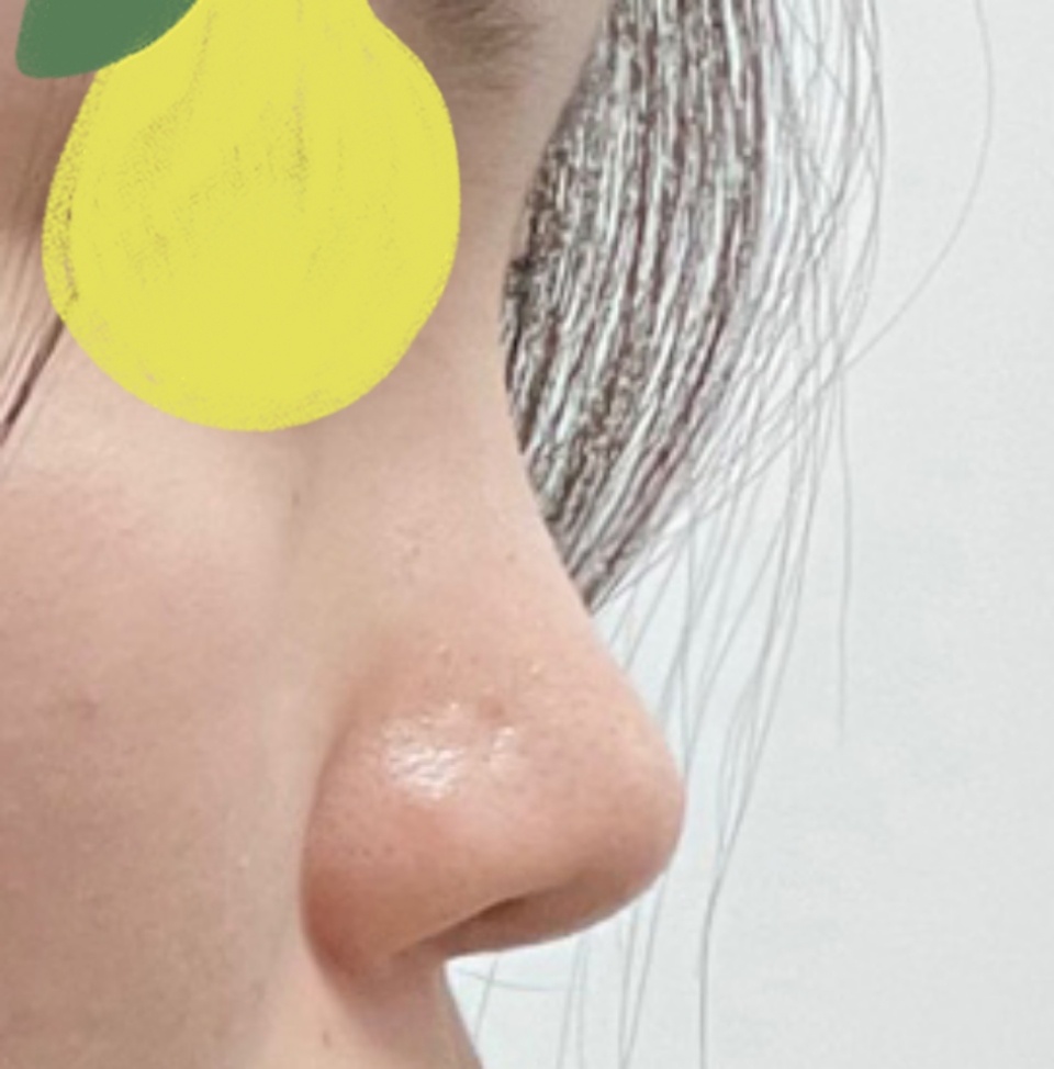 코컴플렉스 이제 아니에요!!