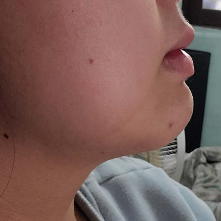 전후 차이 확 나요 ㅎㅎㅎ